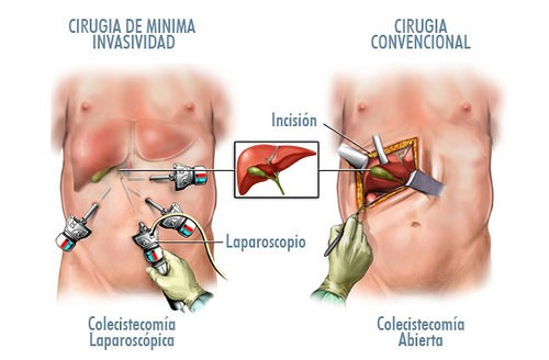 foto operacion de vesicula biliar dr jose fernandez cirujano cubano en tacna peru